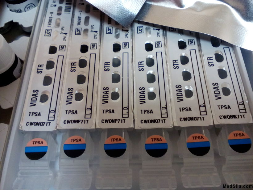 Стрипы для определения ПСА